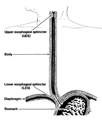 Barrett’s Esophagus 527 Barretts Esophagus 5 09 1