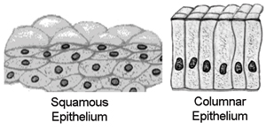 Barrett’s Esophagus 527 Barretts Esophagus 5 09 2